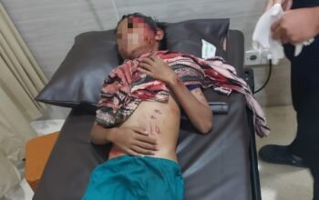 Buaya Serang Bocah 11 Tahun di Bontang, Warga Terjun Selamatkan