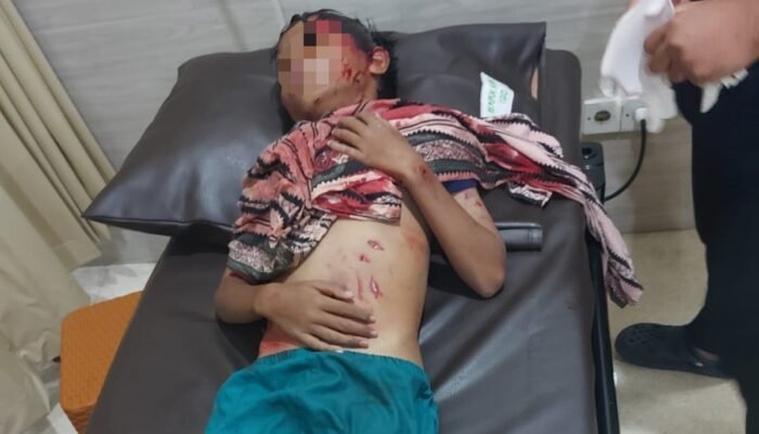 Buaya Serang Bocah 11 Tahun di Bontang, Warga Terjun Selamatkan