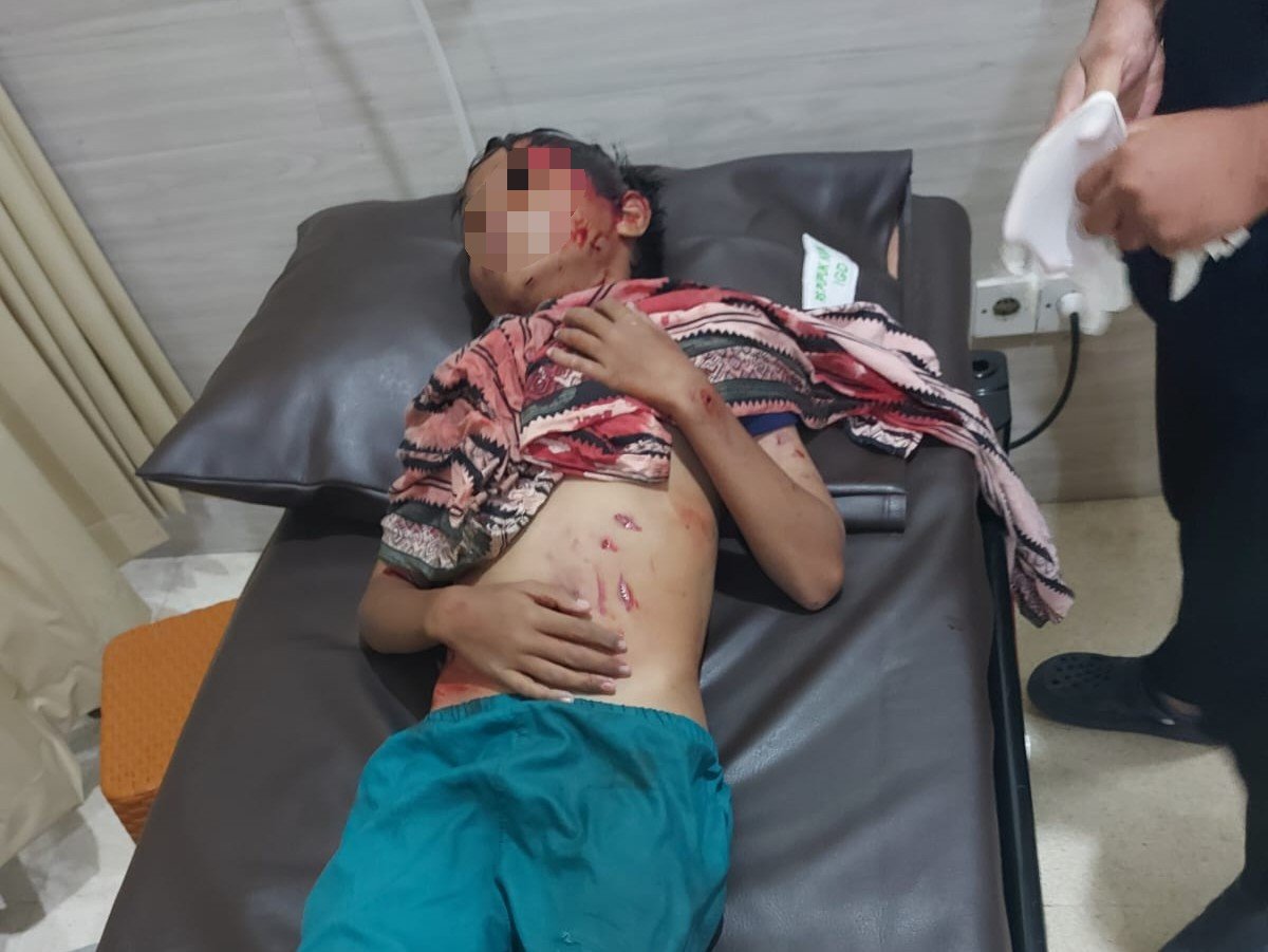 Bocah korban serangan buaya di Loktuan Bontang