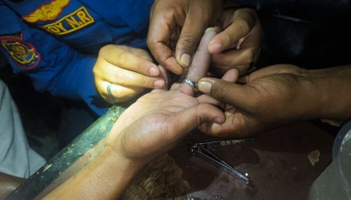 Aksi Cepat Damkar Bontang, Cincin di Jari Warga Berhasil Dilepas dengan Aman